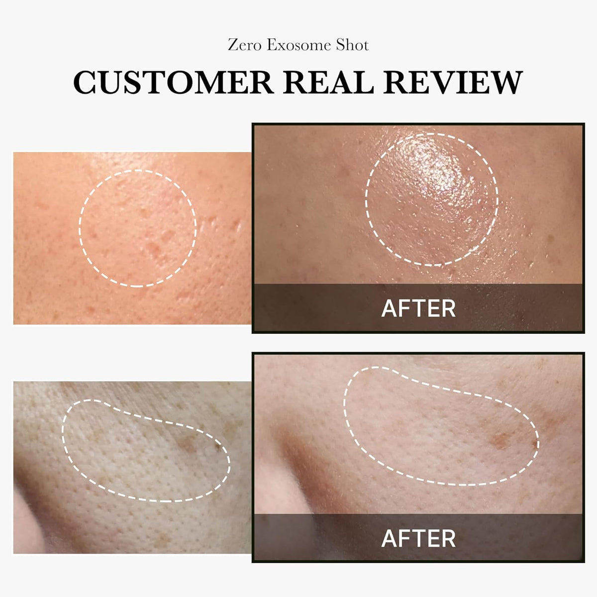 medicube - One Day Exosome Shot Pore Ampoule 2000 Medicube Ecuador Productos Originales Cosmetica Coreana skincare coreano