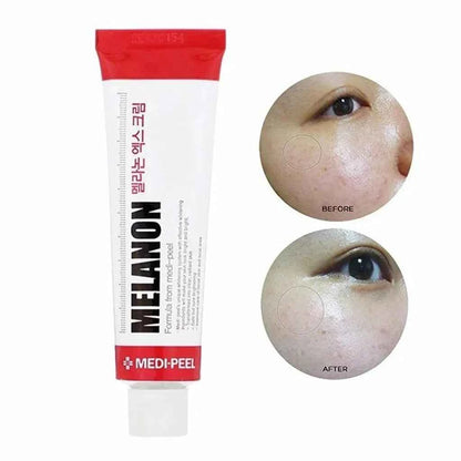 [MEDIPEEL]  Melanon X Cream