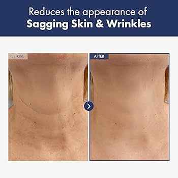 NATUREKIND - Intense Lifting Neck Cream