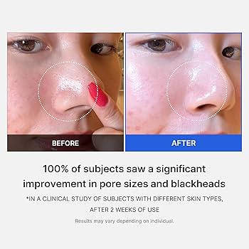 medicube - Zero Pore Pad 2.0 [70 pads]