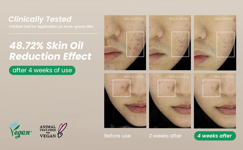 [AXIS-Y] Spot the Difference Blemish Treatment 15ml AXIS-Y Ecuador Productos Originales Cosmetica Coreana