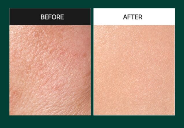 MEDI-PEEL - Phyto Cica-nol B5 3000 Shot Serum [50ml]