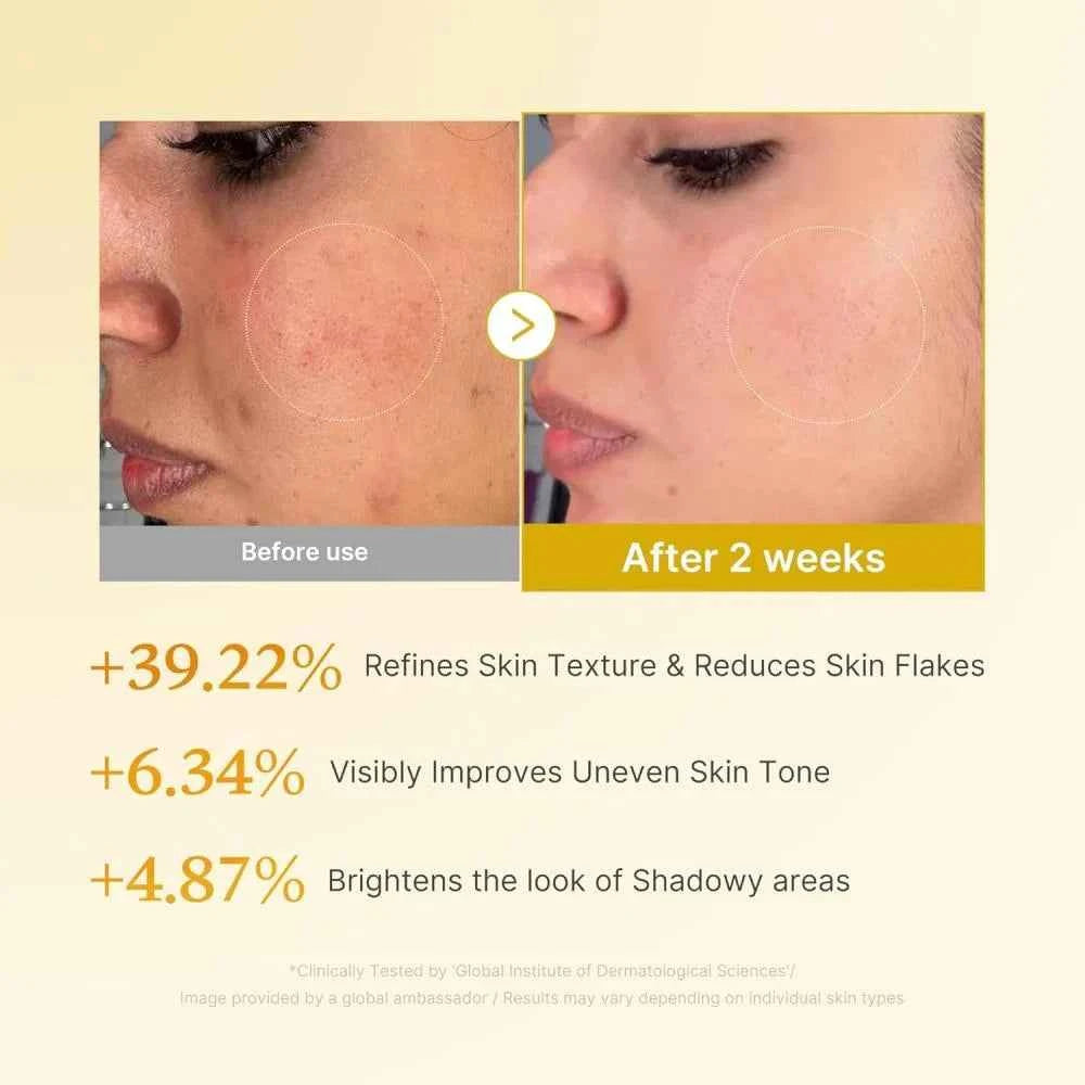 medicube - Kojic Acid Turmeric Resurfacing Toner [250ml]