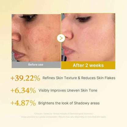 medicube - Kojic Acid Turmeric Resurfacing Toner [250ml]