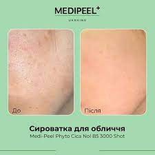 MEDI-PEEL - Phyto Cica-nol B5 3000 Shot Serum [50ml]
