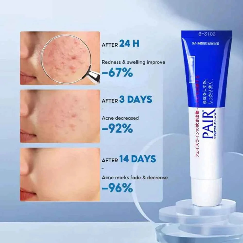 LION - Pair Acne Cream W [14g]