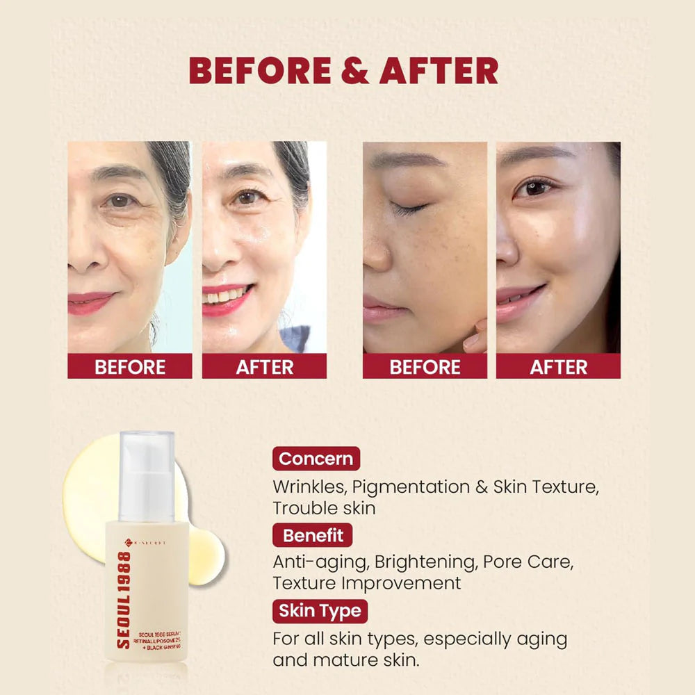 KSECRET - SEOUL 1988 Serum : Retinal Liposome 2% + Black Ginseng [30ml]